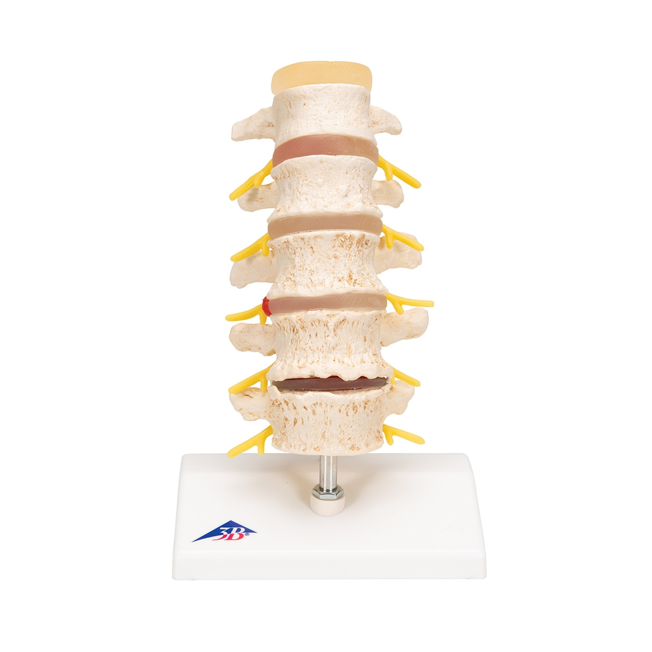 Prolapsmodel med vertebral defects