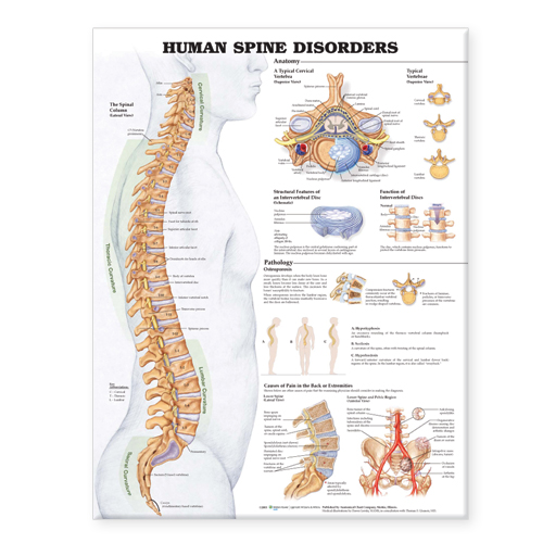 NBN Planche The Human Spine Disorders, Ulamineret