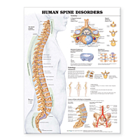  NBN Planche The Human Spine Disorders, Ulamineret