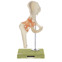  Somso Hofteled Funktionsmodel