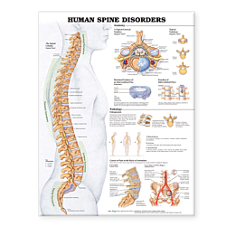 NBN Planche The Human Spine Disorders, Ulamineret